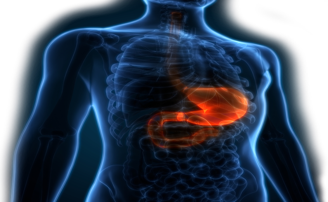 Study to Assess the Efficacy of Tradipitant in Relieving Symptoms of Gastroparesis