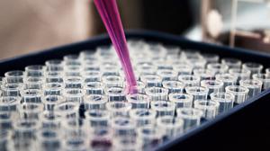  Does Apolipoprotein A-V (APOA5) the genetic code of a protein, affect the levels of triglycerides (a type of fat) in the blood, 