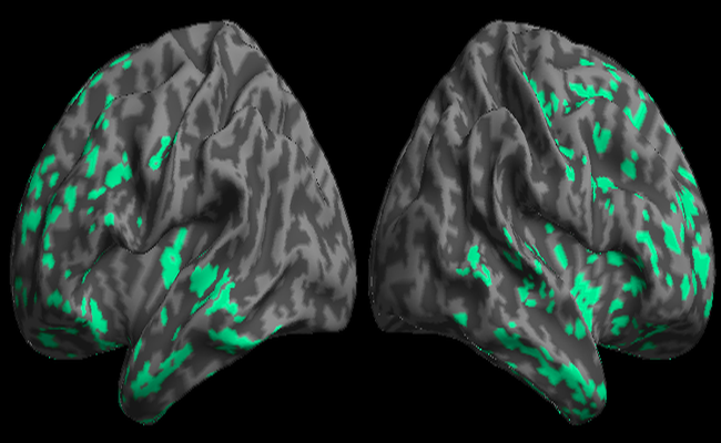 The Neural Basis for Amyotrophic Lateral Sclerosis